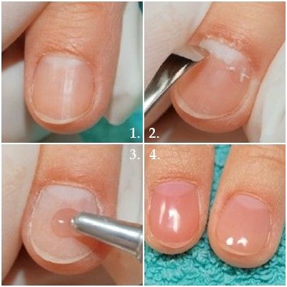 nagel_prothese_fur_finger_diaman.jpg